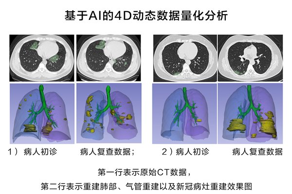 现在的新冠肺炎最新情况分析