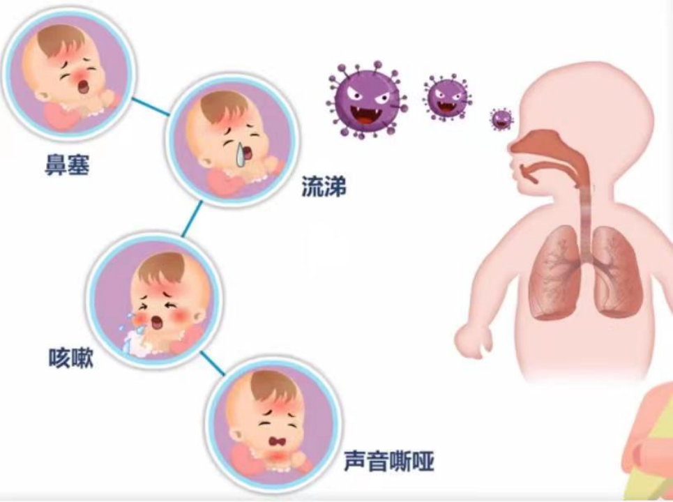 最新毒株与结膜炎，警惕与应对